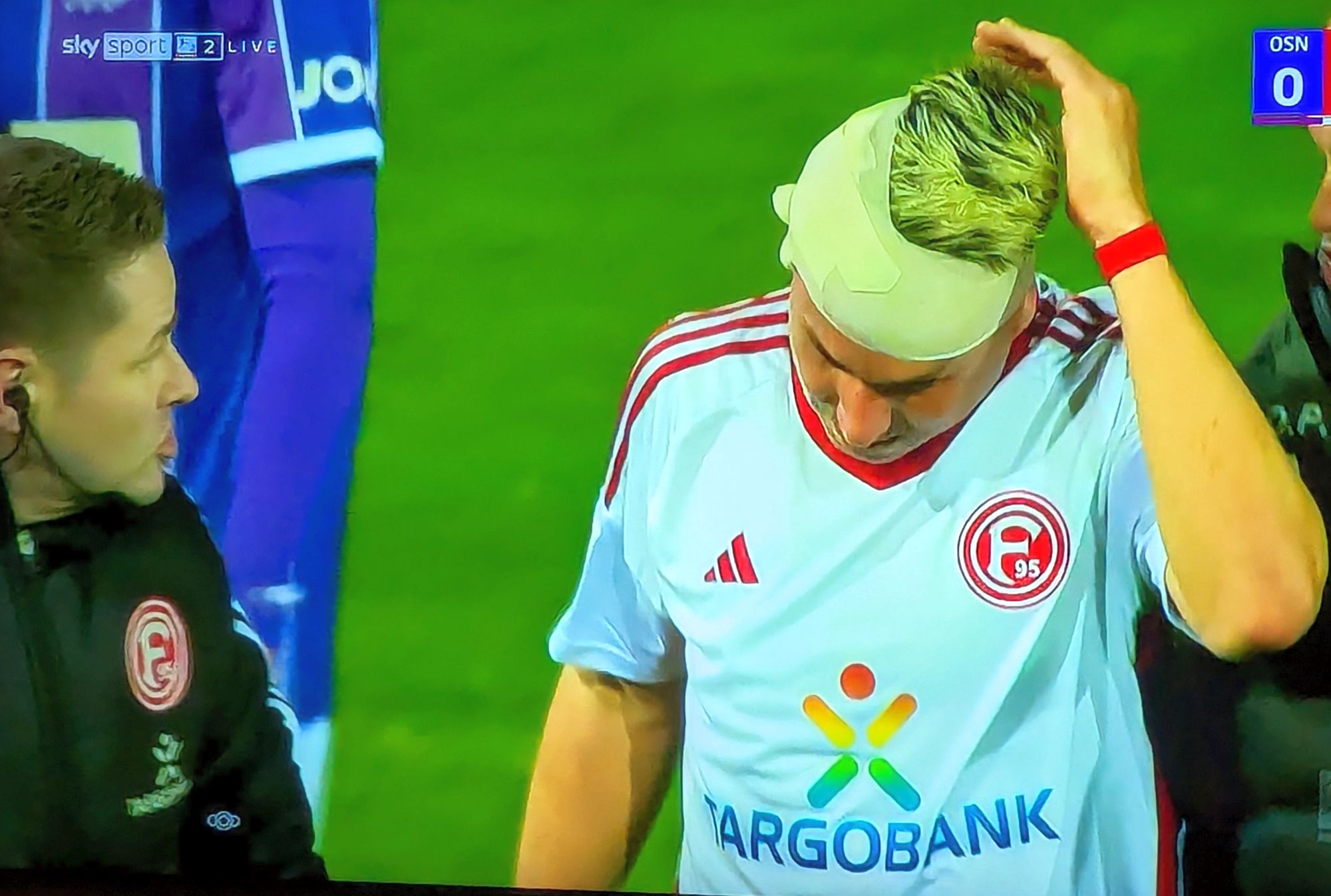 Osnabrück vs F95: Felix Klaus kriegt nen Turban (Screenshot Sky)