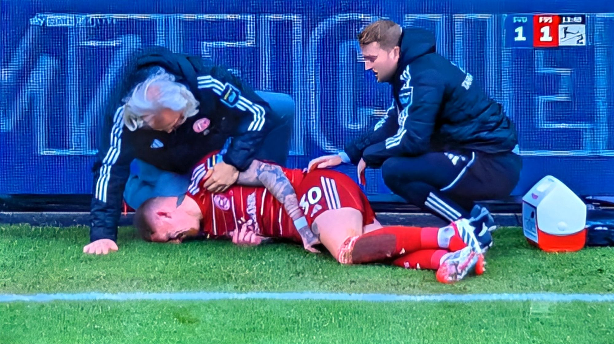 Darmstadt vs F95: Jordy verletzt ohne Fremdeinwirkung (Screenshot Sky)