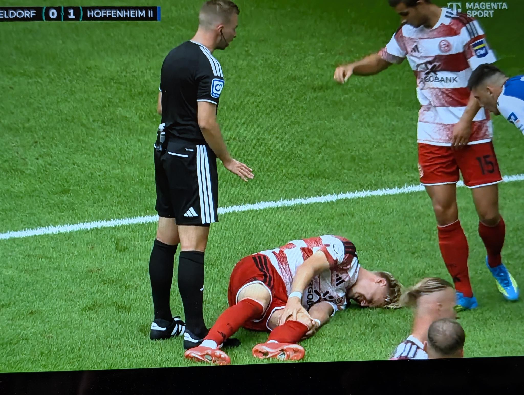 F95 vs Hoffenheim II: Oh je, Felix Meiser verletzt ... (Screenshot: Magenta TV)
